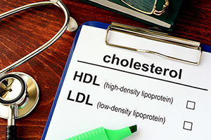Help! Should I be concerned about my high HDL level?